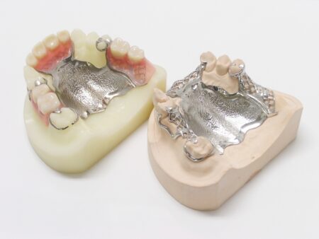 当院で取り扱う入れ歯の種類