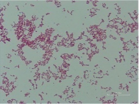 歯周病と認知症の関係――いま分かっていることと、今日からできる予防