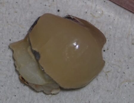 詰め物・被せ物が取れてしまったとき、やってはいけないこと