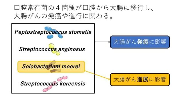 歯周病と大腸がんの“意外な関係”―口の中から始まる全身の予防