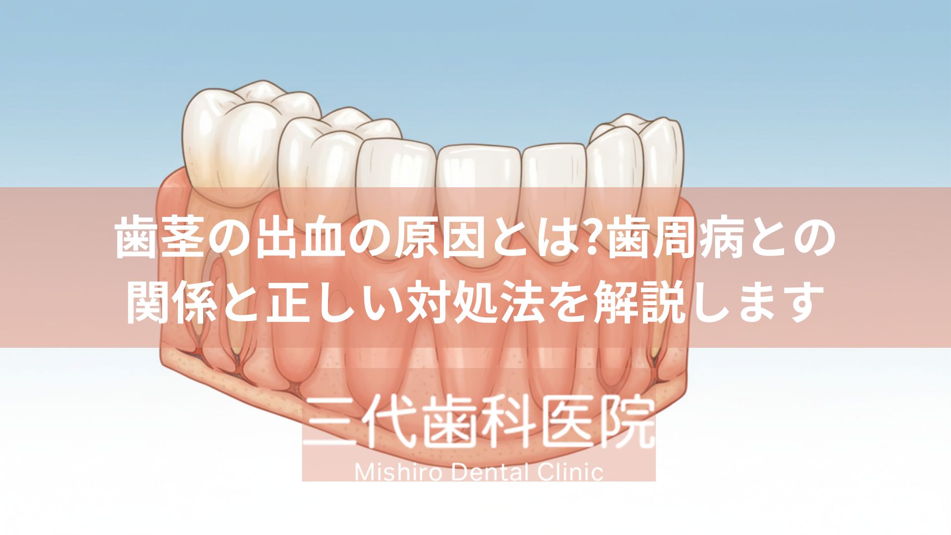 歯茎の出血の原因とは?歯周病との関係と正しい対処法を解説します