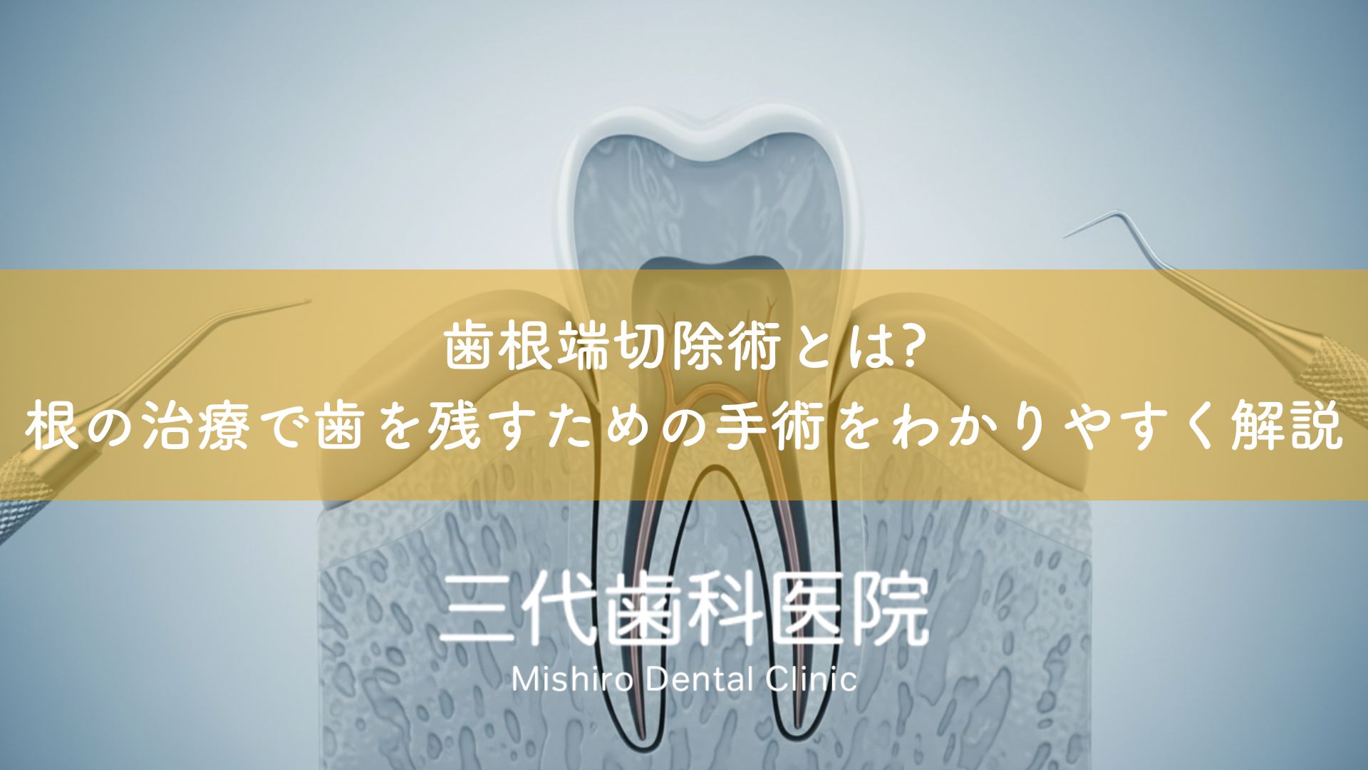 歯根端切除術とは?根の治療で歯を残すための手術をわかりやすく解説