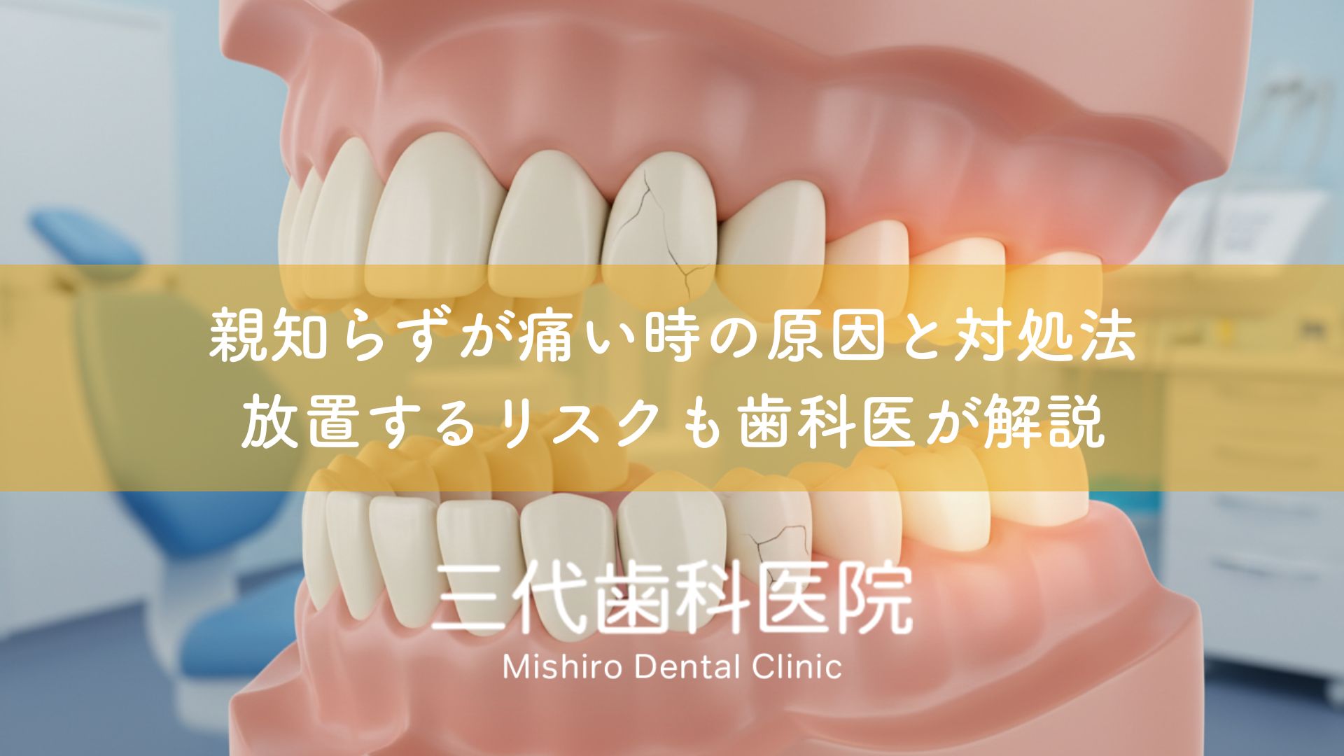 親知らずが痛い時の原因と対処法〜放置するリスクも歯科医が解説