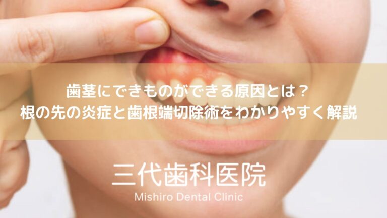 歯茎にできものができる原因とは？根の先の炎症と歯根端切除術をわかりやすく解説