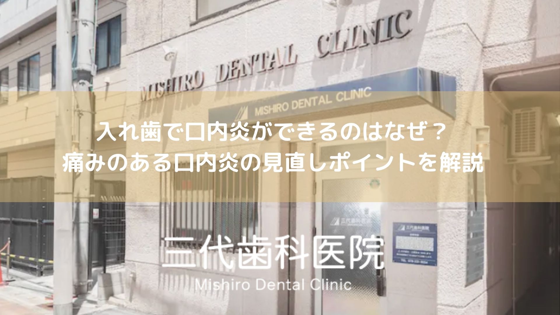入れ歯で口内炎ができるのはなぜ？痛みのある口内炎の見直しポイントを解説