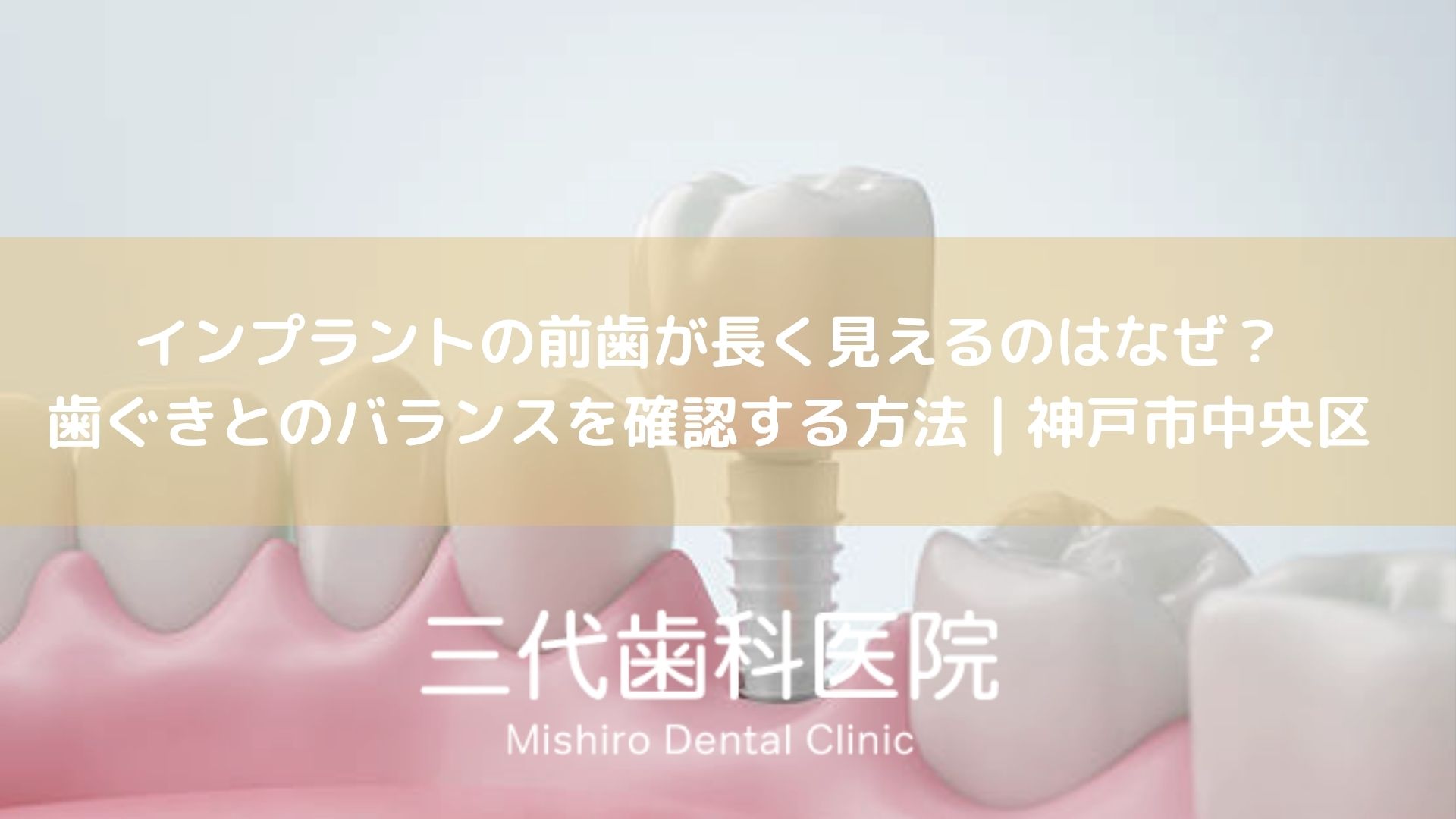 インプラントの前歯が長く見えるのはなぜ？歯ぐきとのバランスを確認する方法｜神戸市中央区
