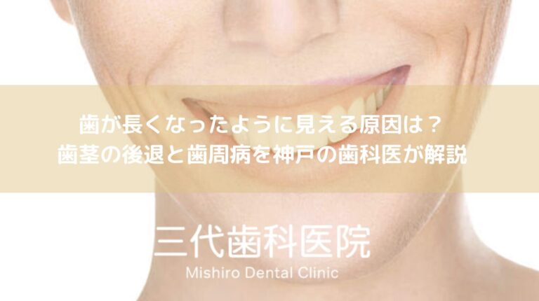 歯が長くなったように見える原因は?歯茎の後退と歯周病を神戸の歯科医が解説