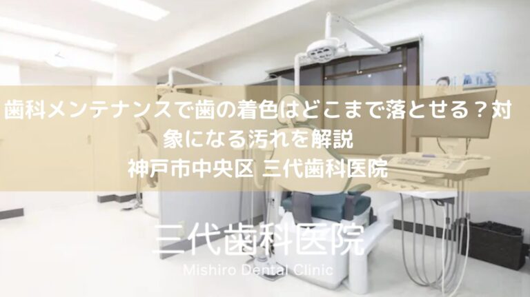 歯科メンテナンスで歯の着色はどこまで落とせる?対象になる汚れを解説|神戸市中央区 三代歯科医院