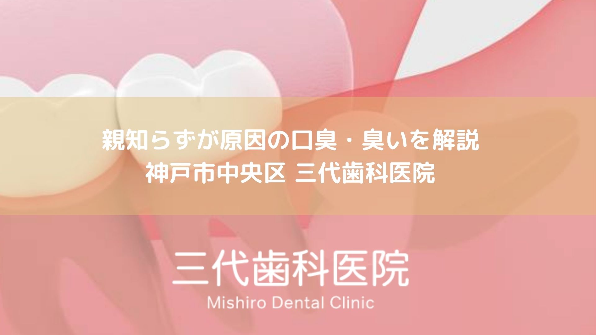 親知らずが原因の口臭・臭いを解説｜神戸市中央区 三代歯科医院