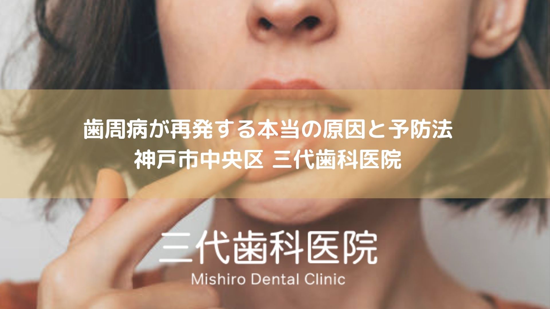 歯周病が再発する本当の原因と予防法｜神戸市中央区 三代歯科医院