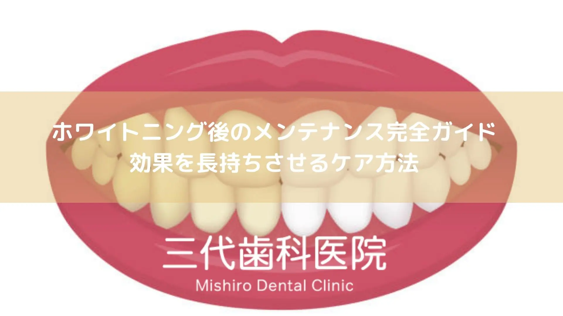 ホワイトニング後のメンテナンス完全ガイド｜効果を長持ちさせるケア方法