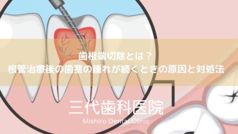 歯根端切除とは？根管治療後の歯茎の腫れが続くときの原因と対処法