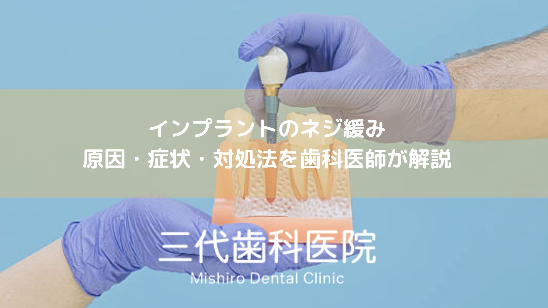 インプラントのネジ緩み｜原因・症状・対処法を歯科医師が解説