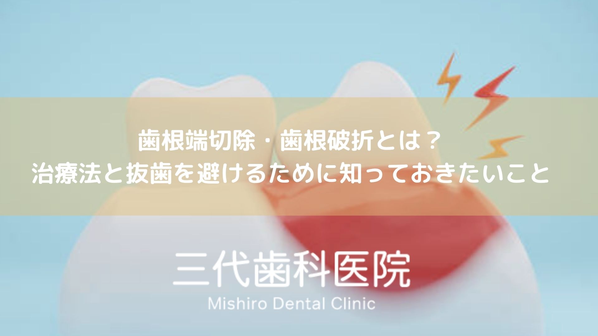 歯根端切除・歯根破折とは？治療法と抜歯を避けるために知っておきたいこと