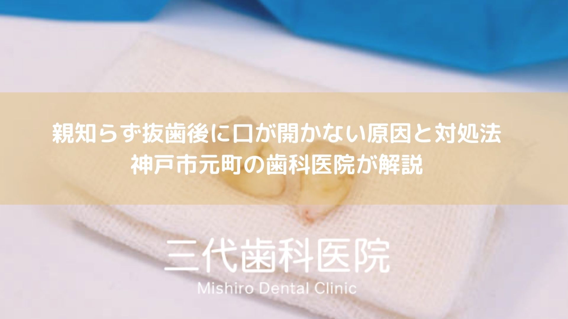 親知らず抜歯後に口が開かない原因と対処法｜神戸市元町の歯科医院が解説