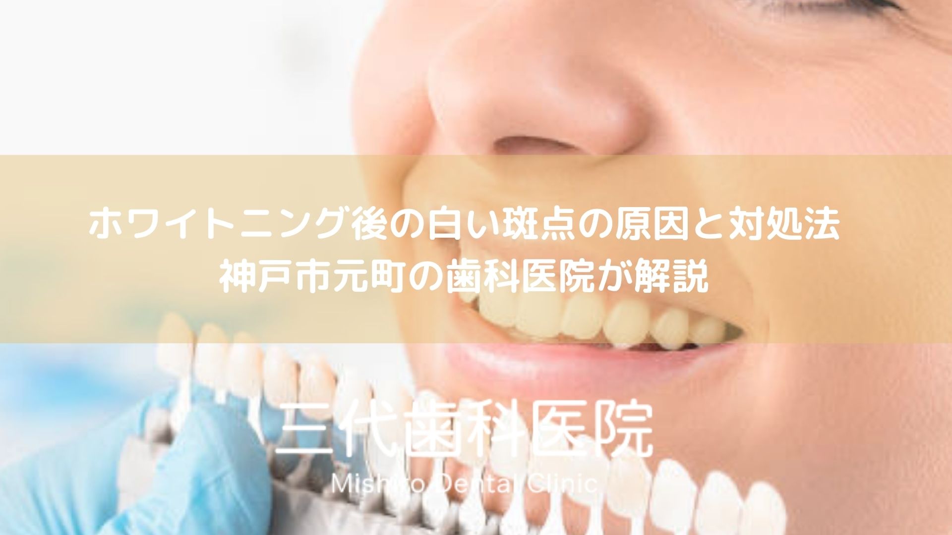 ホワイトニング後の白い斑点の原因と対処法｜神戸市元町の歯科医院が解説