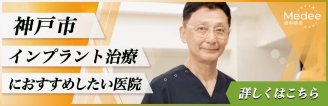 神戸市インプラント治療におすすめしたい医院